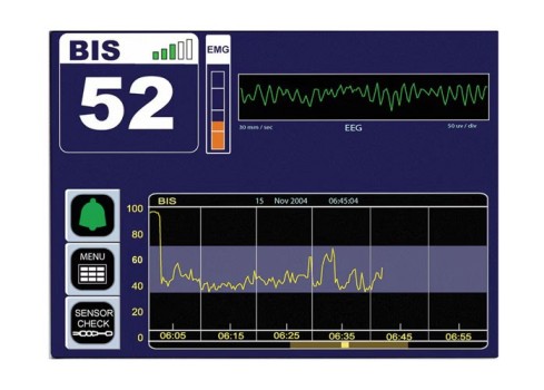 Brain Monitoring