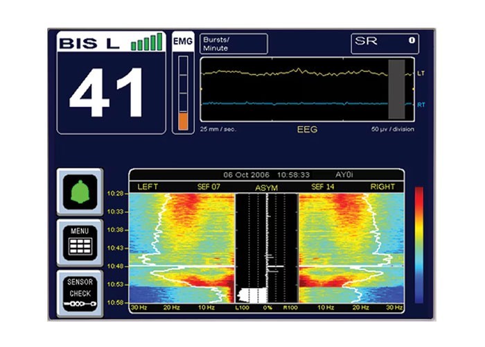 BIS Complete 4-Channel Monitor